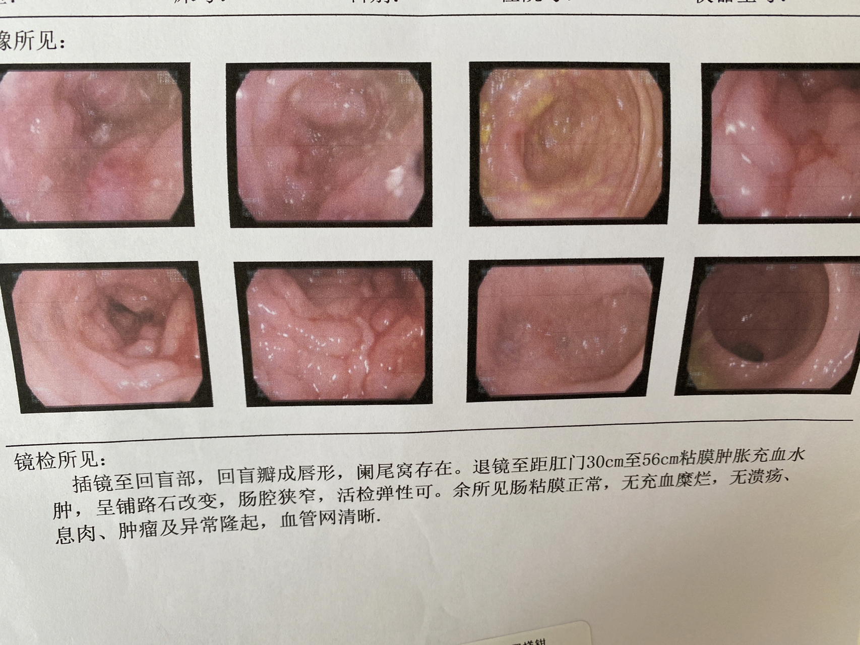 克罗恩最新消息