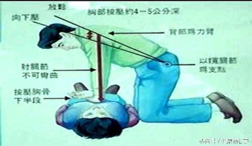 心肺复苏步骤最新标准
